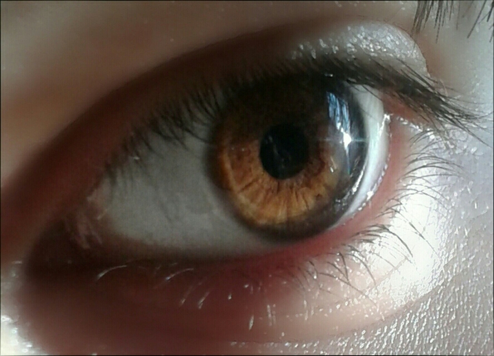 eye