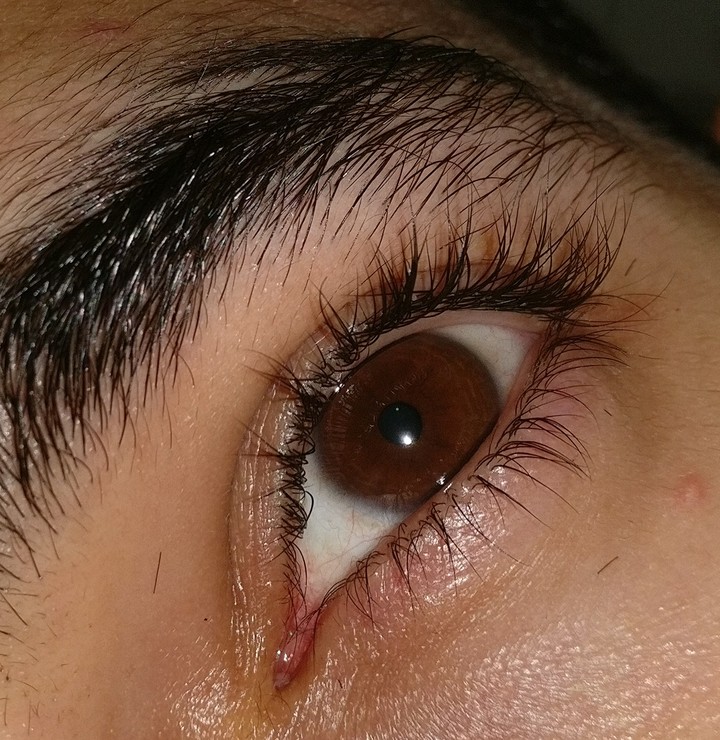 my eye's