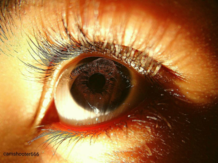 Clicked my eye