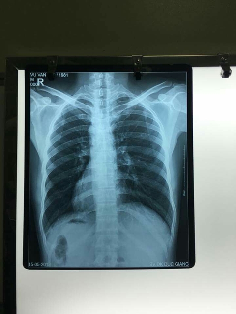 xray