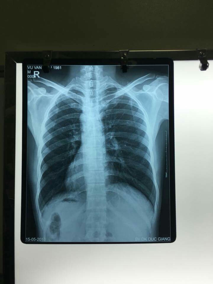 xray