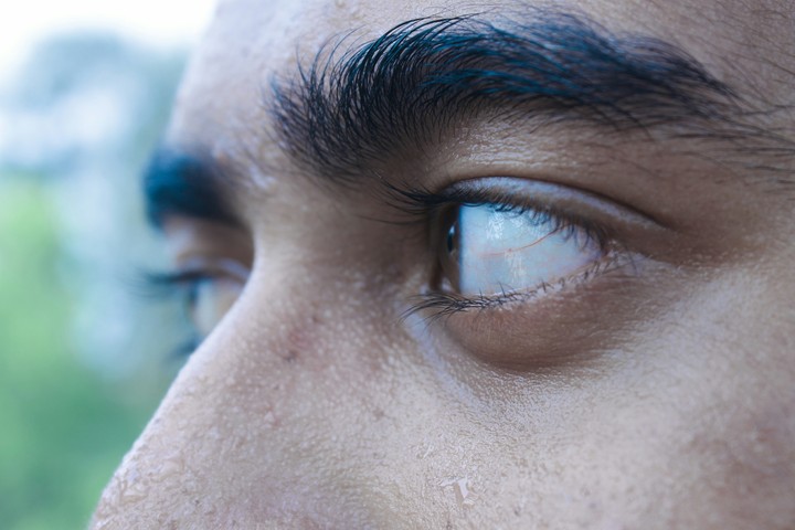 Eye