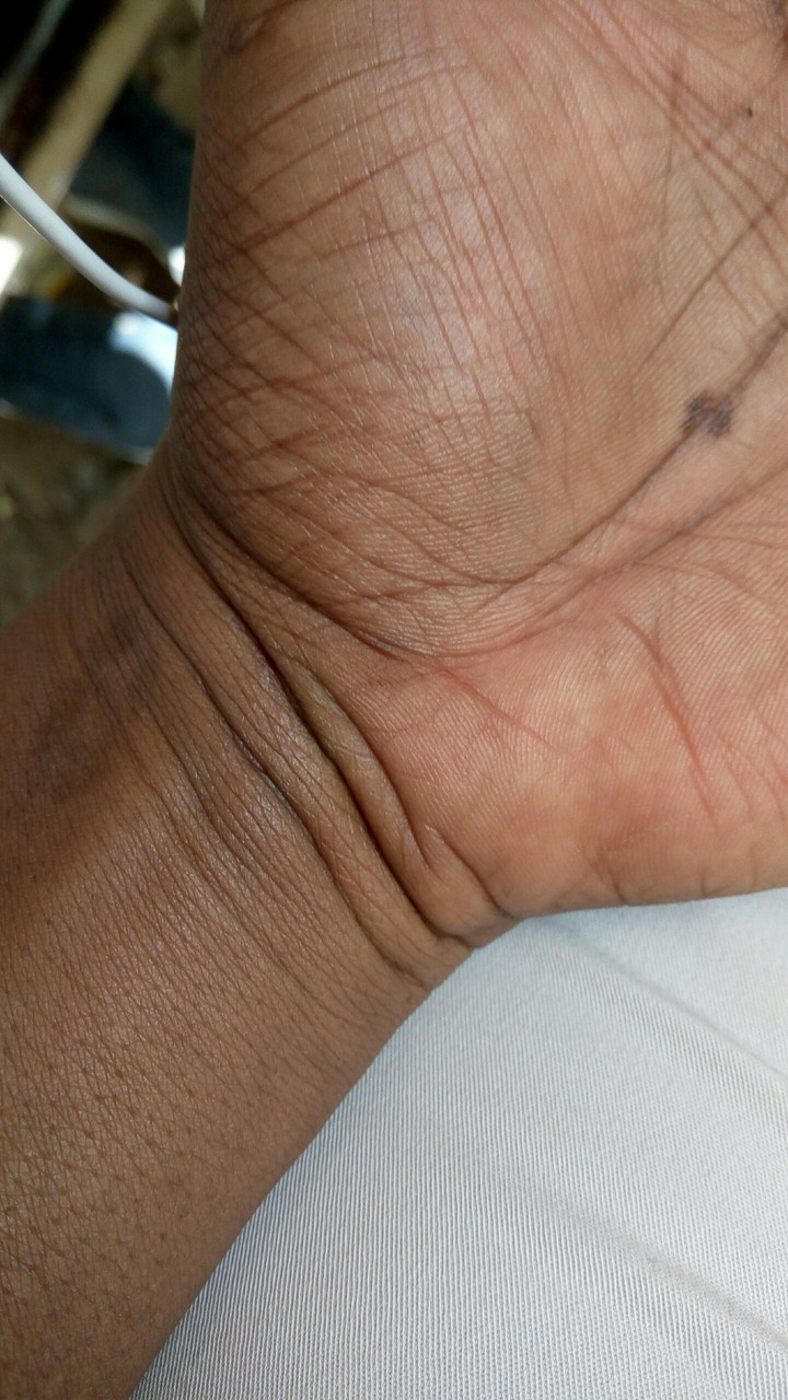 palm