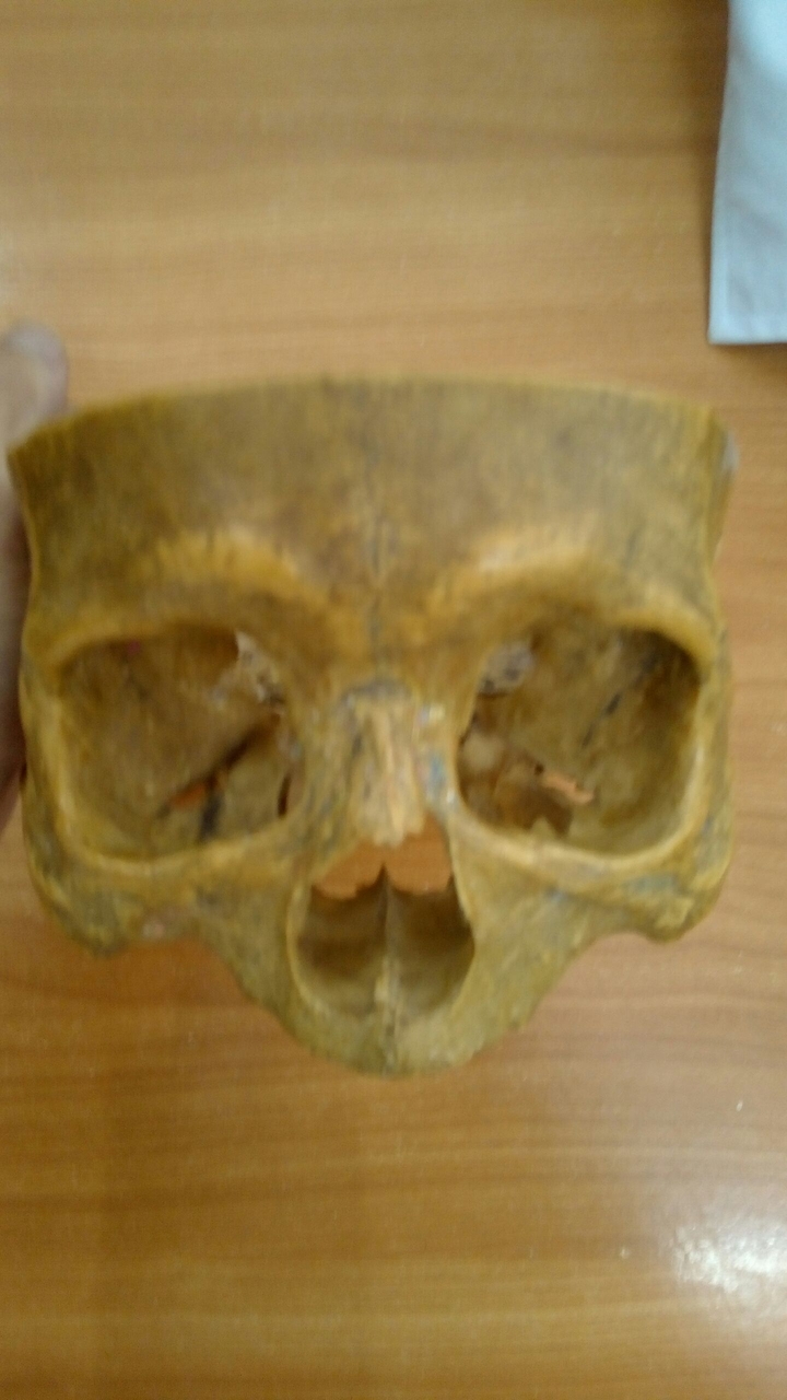 head bone