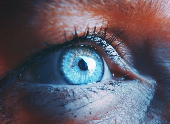 Eye