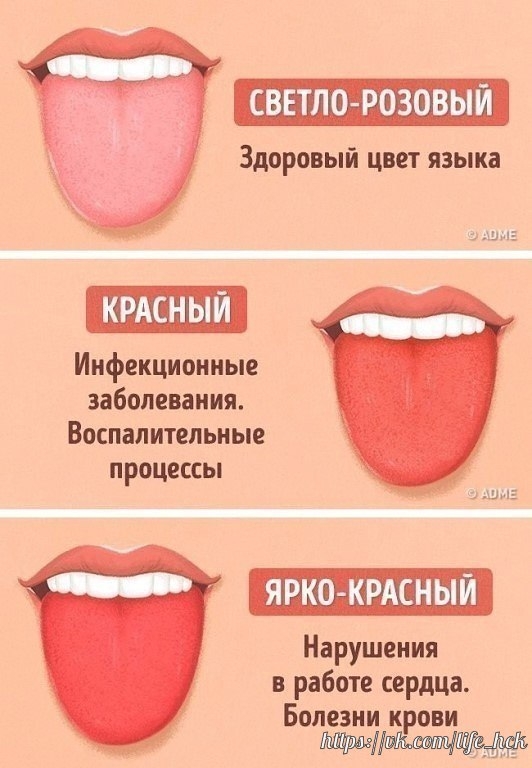 2)