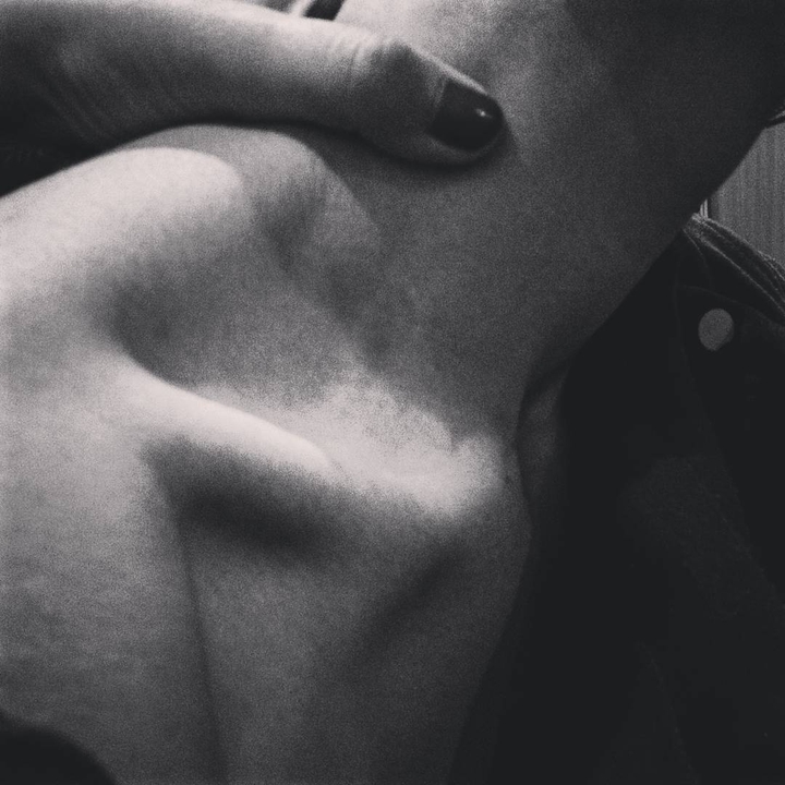 body