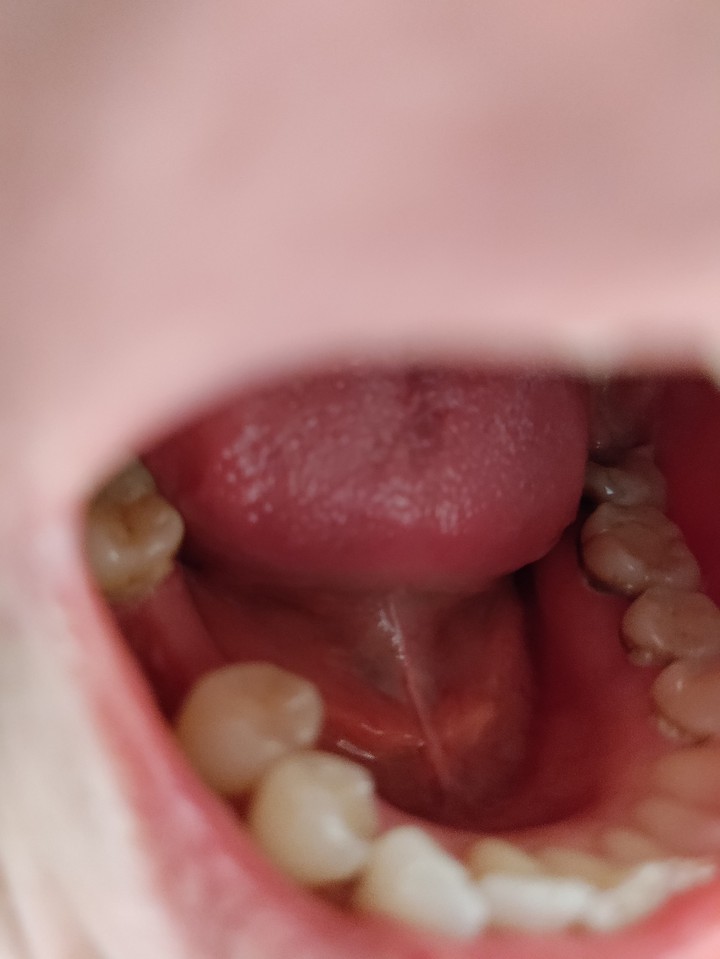 mouth