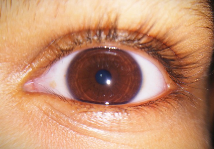An Human Eye