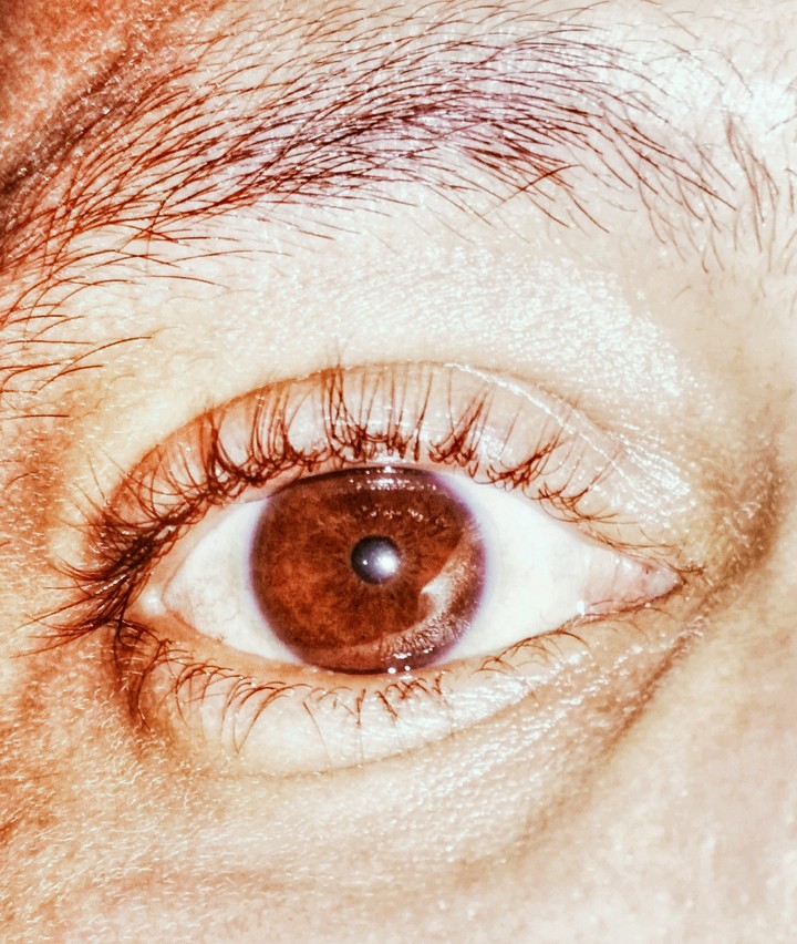 eye