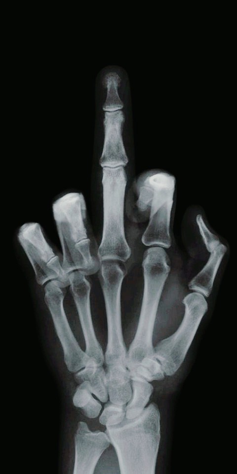 обои bone, Medical