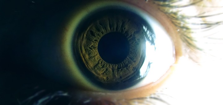 eye