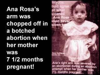 stop abortion