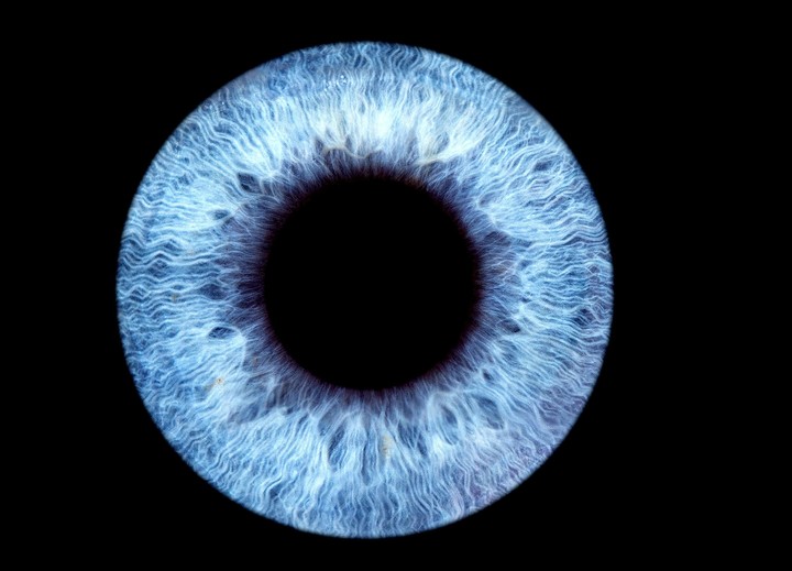 Eye