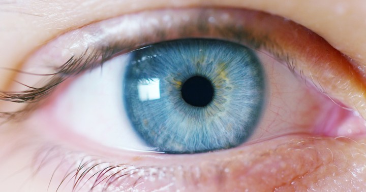 Oeil