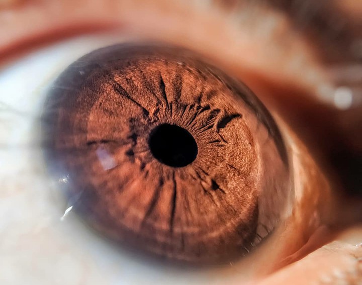 Eye