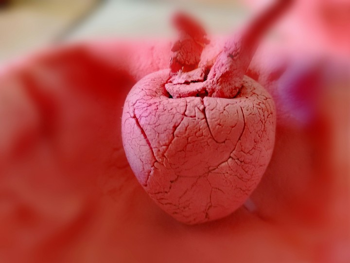 appel