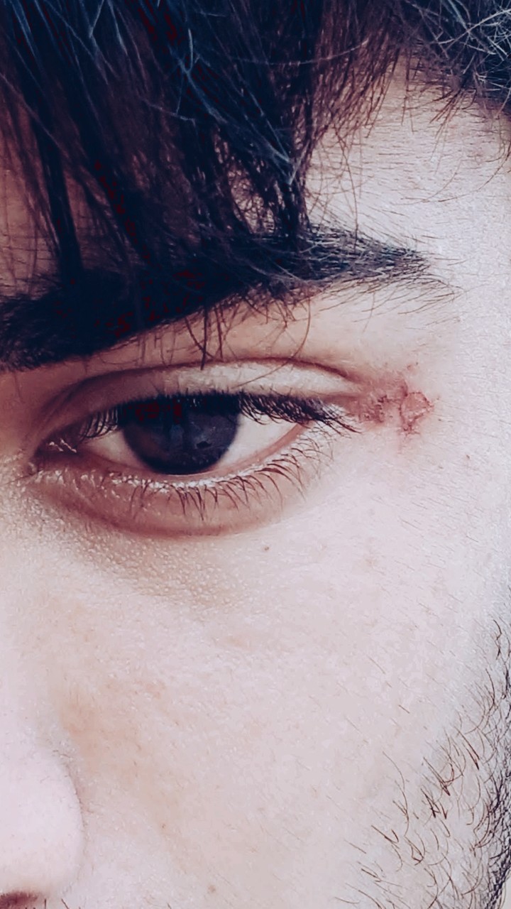 Eyeb