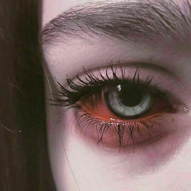 im not?