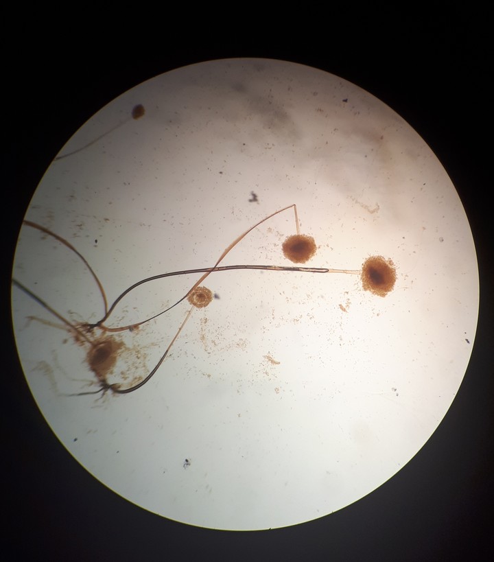 Rhizopous