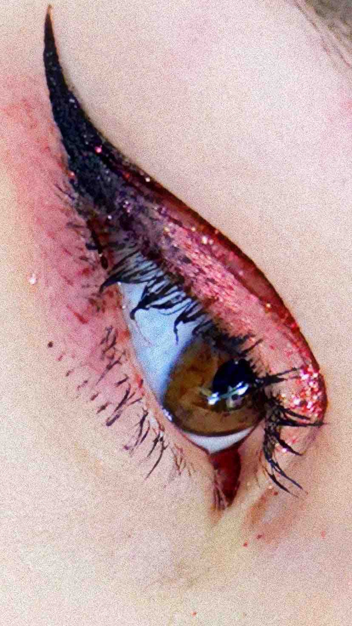 pinky eye