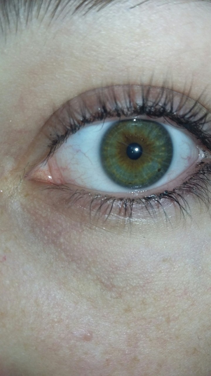 my eye 