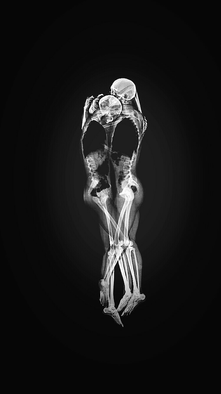 two bodies one heart