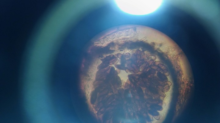 observing fungus