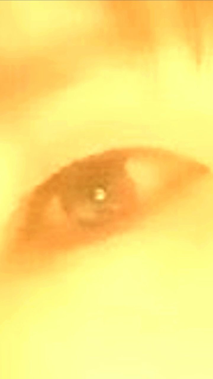 눈