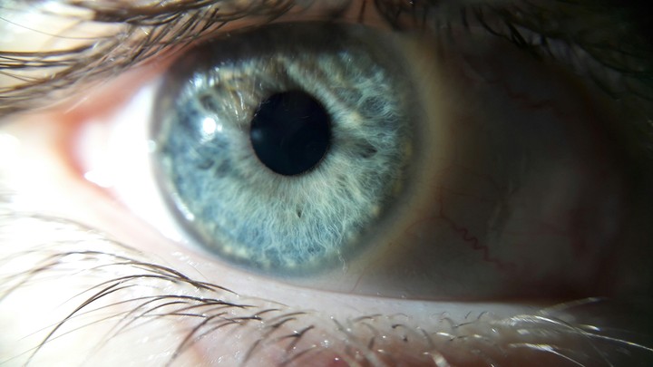 eye