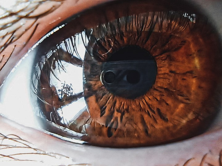 eye