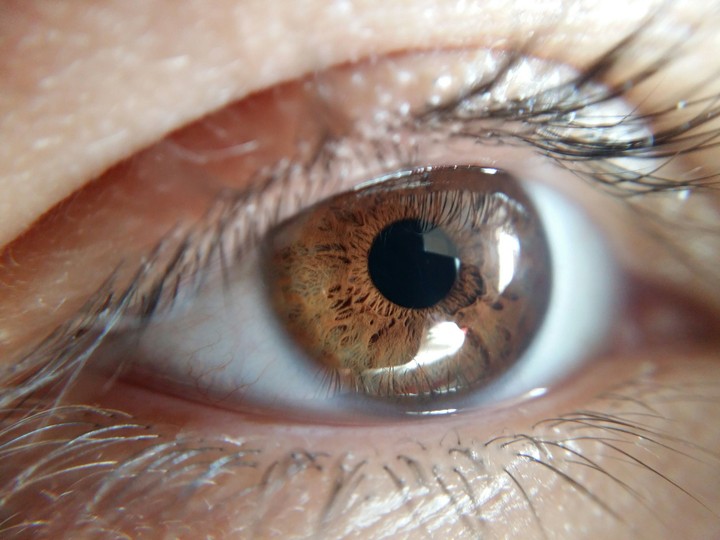 EYE