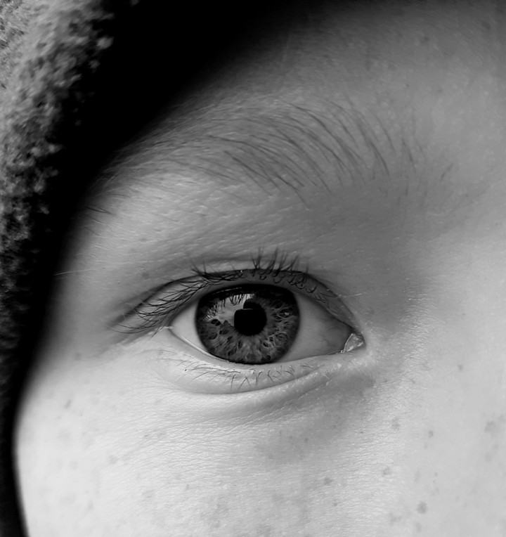 Eye