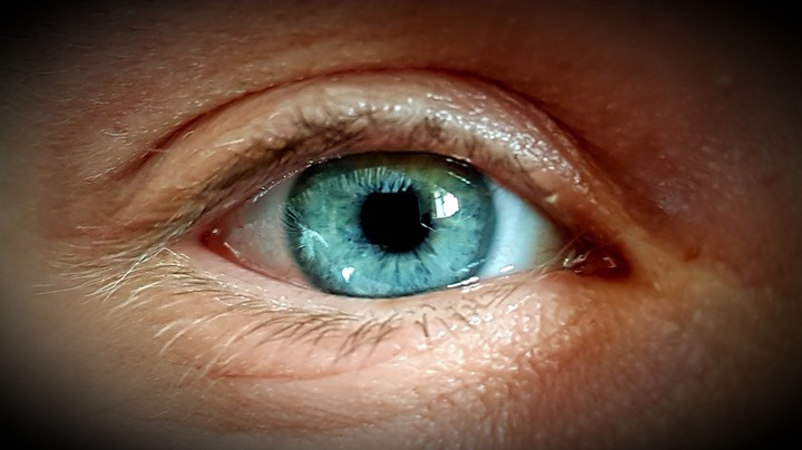 the eye