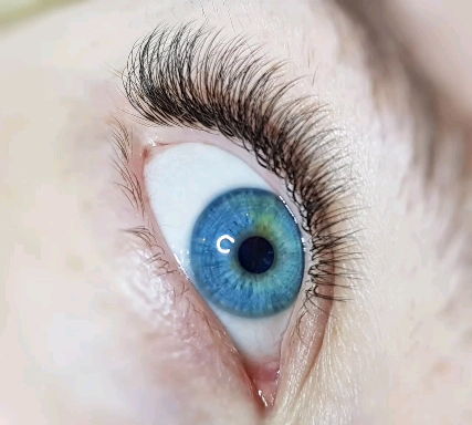 Eye