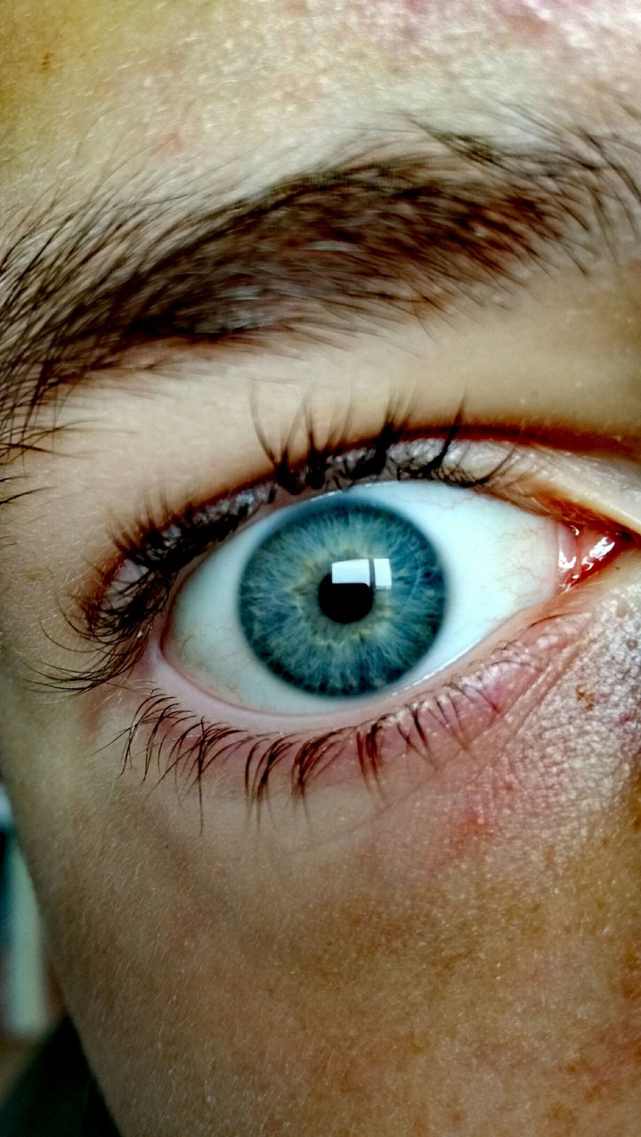 blue eye