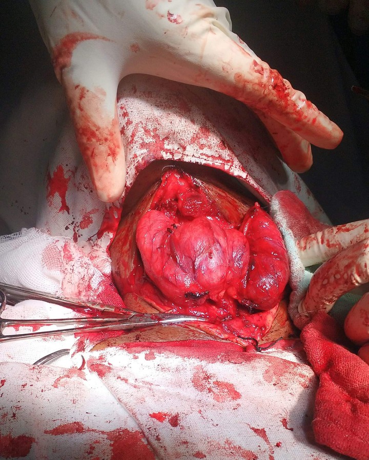 Thyroid Gland