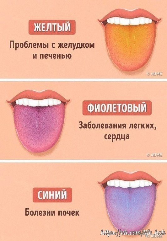 3)
