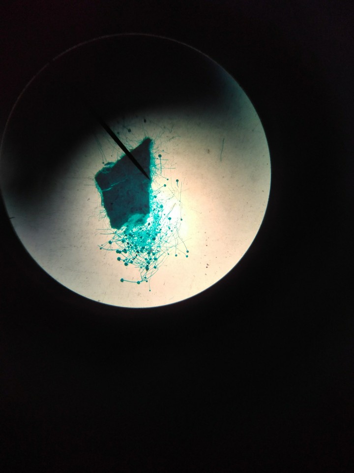 Aspergillus
