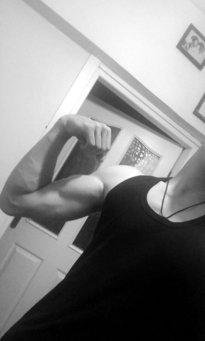 my arm