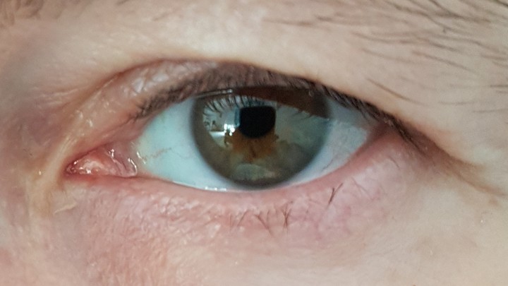 oeil