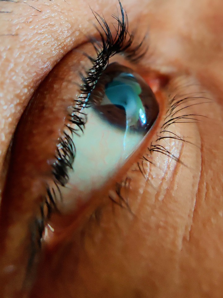 Eye grace