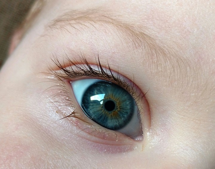 eye