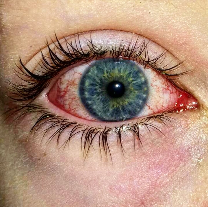 eyes 