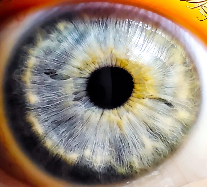 Eye