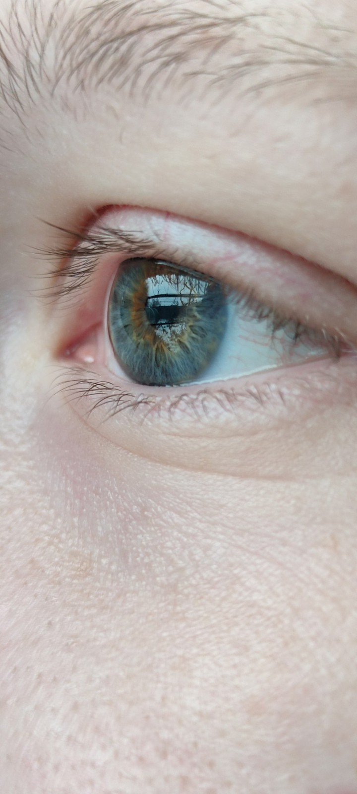 eye
