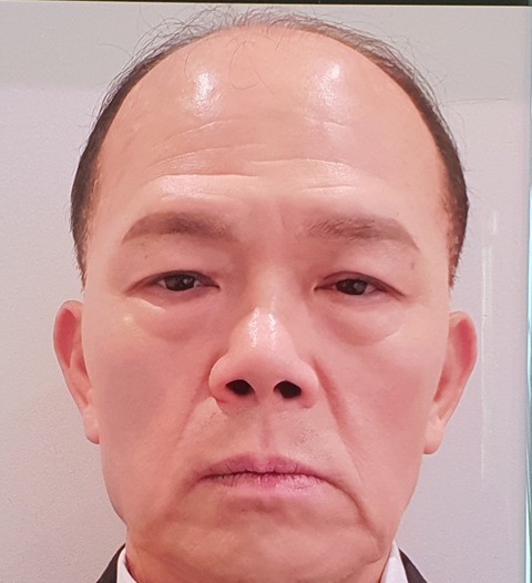 обои jaw, forehead
