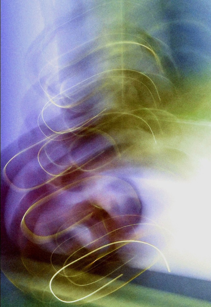 Abstraction