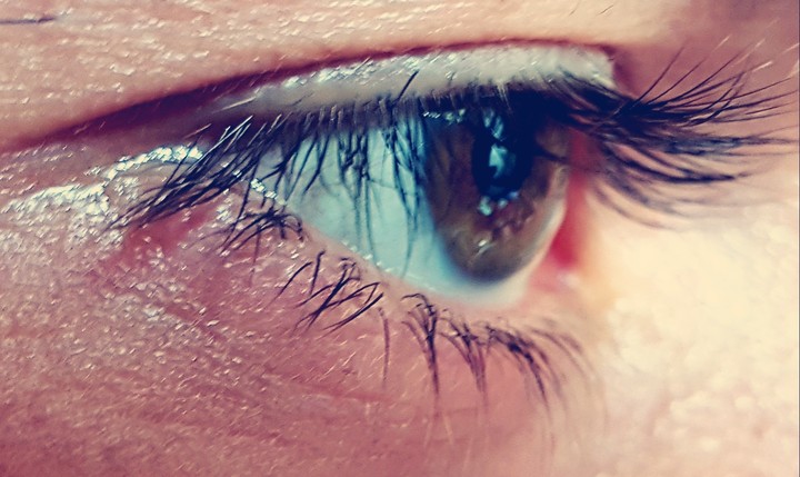 Auge