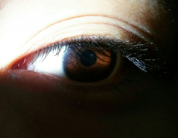 An eye